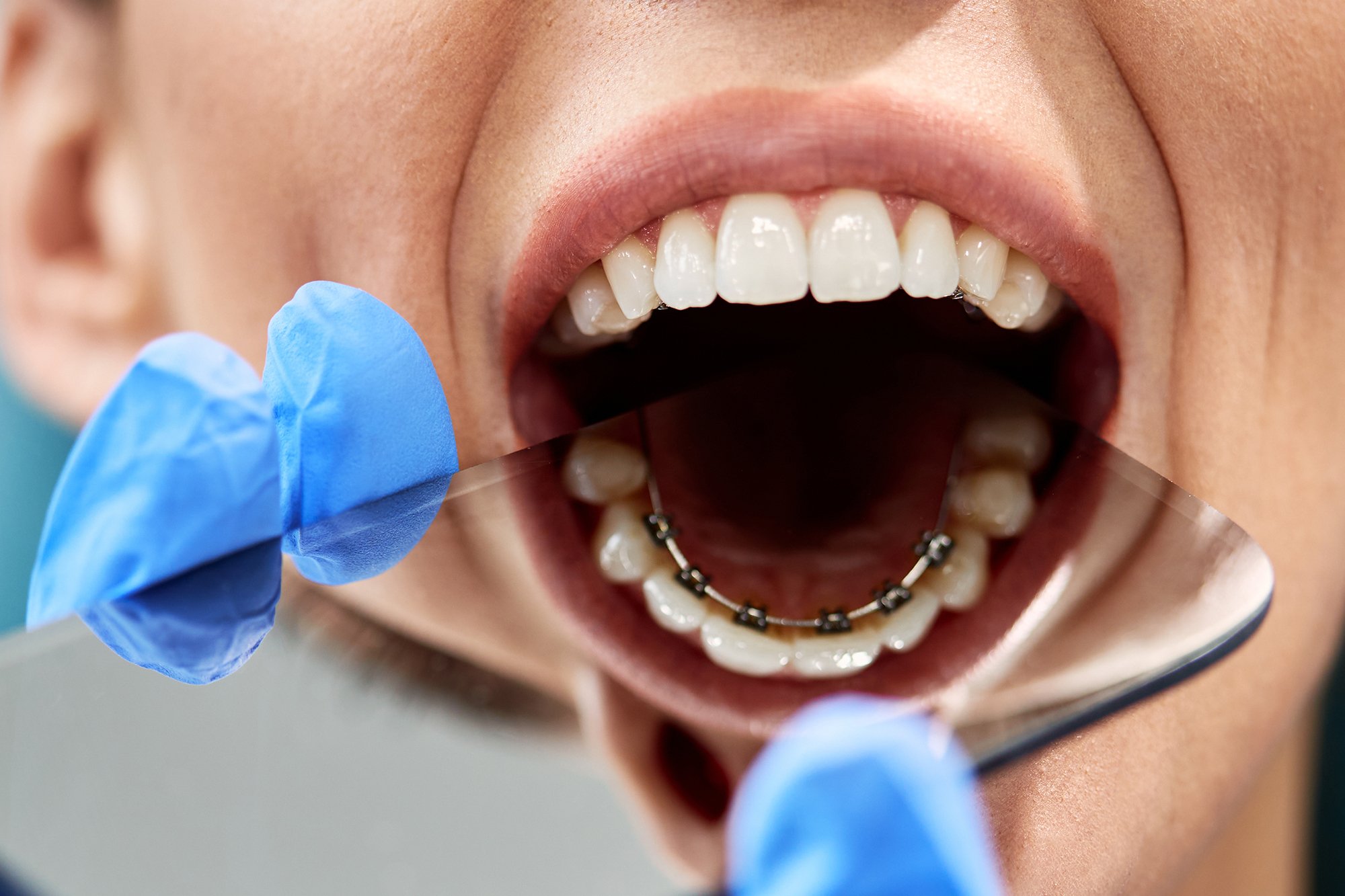 Orthodontics